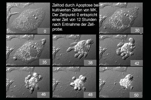 Zelltod durch Apoptose